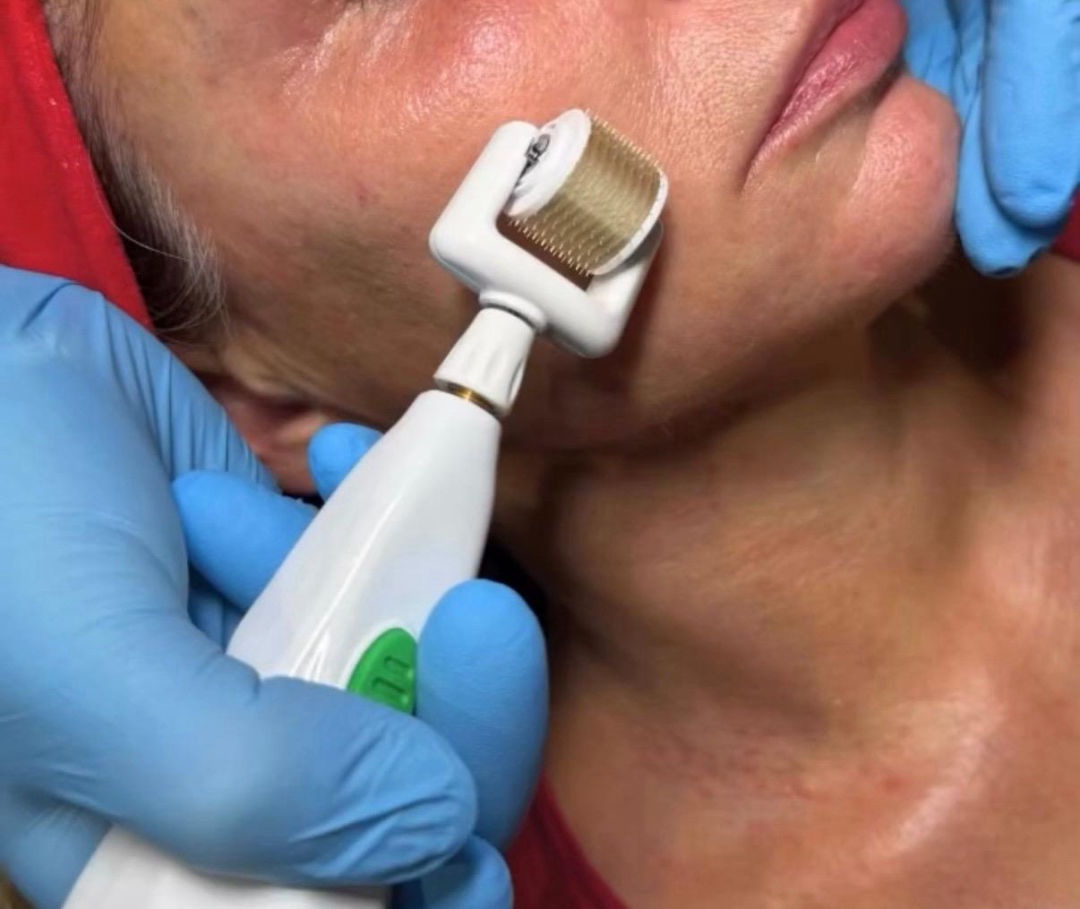 revivia plasma